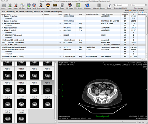 Osirix DICOM Software