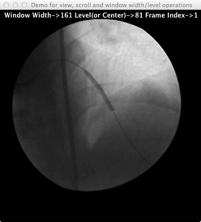 DICOM Window Width/Level Demo